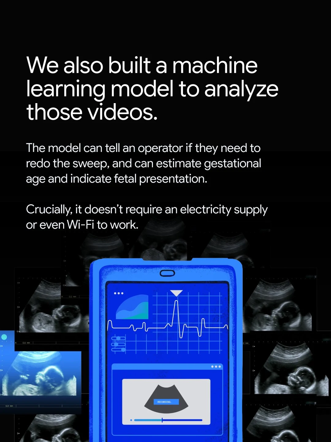 An image displaying text about a machine learning model for analyzing ultrasound videos above a blue handheld device screen showing medical data over a collage of ultrasound images.