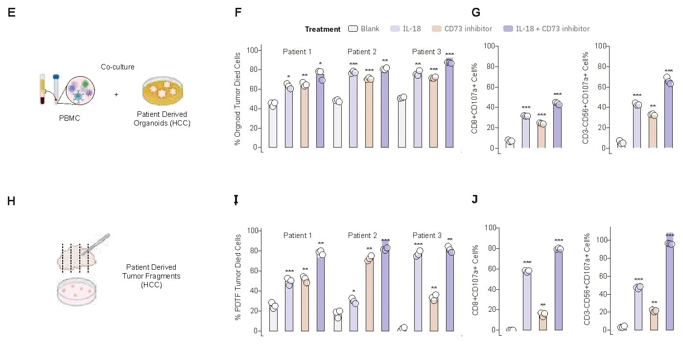 Bar charts showing results from patient-derived organoids and tumor fragments from three liver cancer patients. The charts compare the share of killed tumor cells and activated immune cells across four conditions: control, IL-18, CD73 inhibitor, and the combination of both.