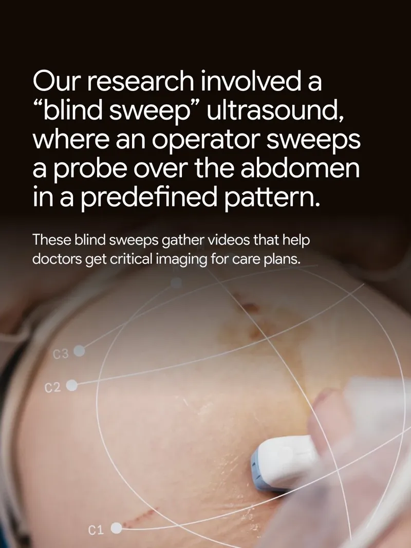 An operator holds an ultrasound probe over an abdomen overlaid with sweep pattern lines accompanied by text describing a "blind sweep" ultrasound research project and how it works.
