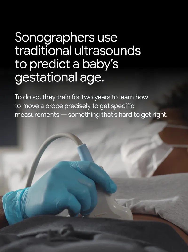 A gloved hand holds an ultrasound probe against a patient's abdomen, beneath text explaining that sonographers train for two years to learn how to precisely measure a baby's gestational age.